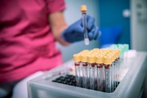 Fertilitetsutredning Göteborgs Kvinnoklinik